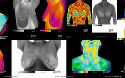 A Brief History of Medical Thermography