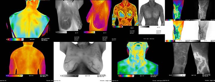 A Brief History of Medical Thermography